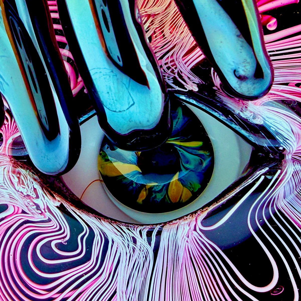 Trichotillomania